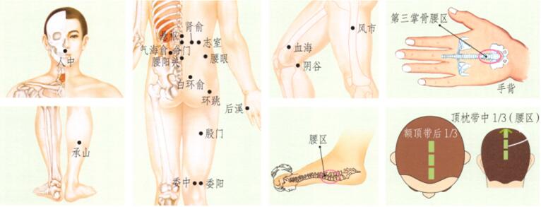 腰痛刮痧