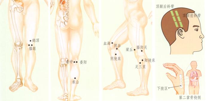 膝关节痛刮痧