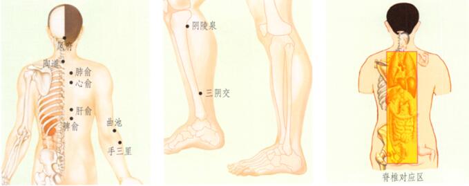 湿疹刮痧