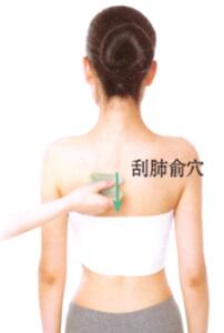 湿疹刮痧