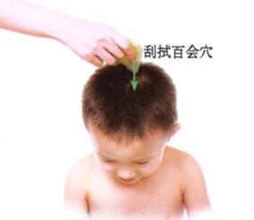 小儿遗尿刮痧