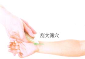 百日咳刮痧