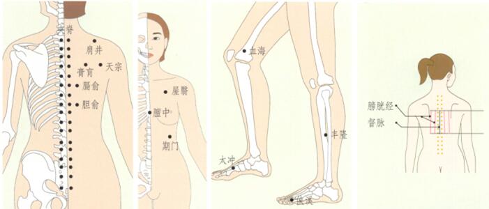 乳腺增生刮痧