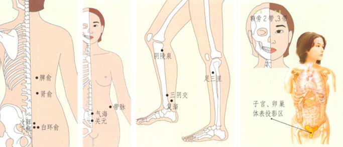 带下病(盆腔炎)刮痧