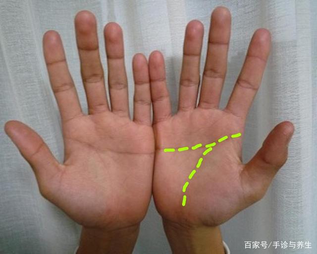 断掌纹的命运_男人左手断掌纹_断手纹和断掌纹一样吗