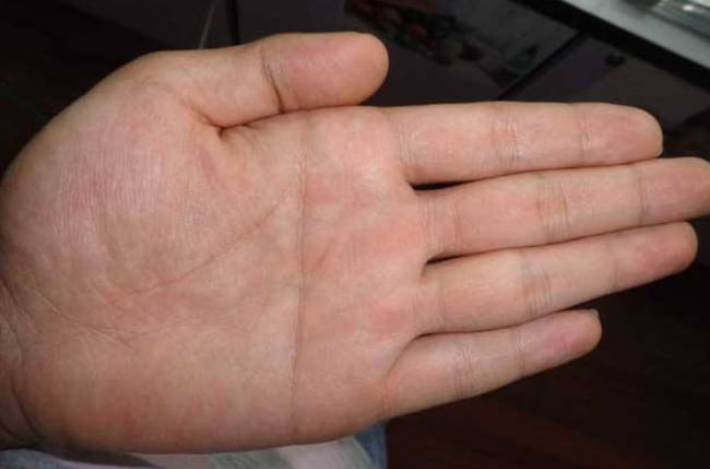 断掌纹的命运_断手纹和断掌纹一样吗_男人左手断掌纹